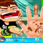 Ben10 Hand Doctor – Free Online Game